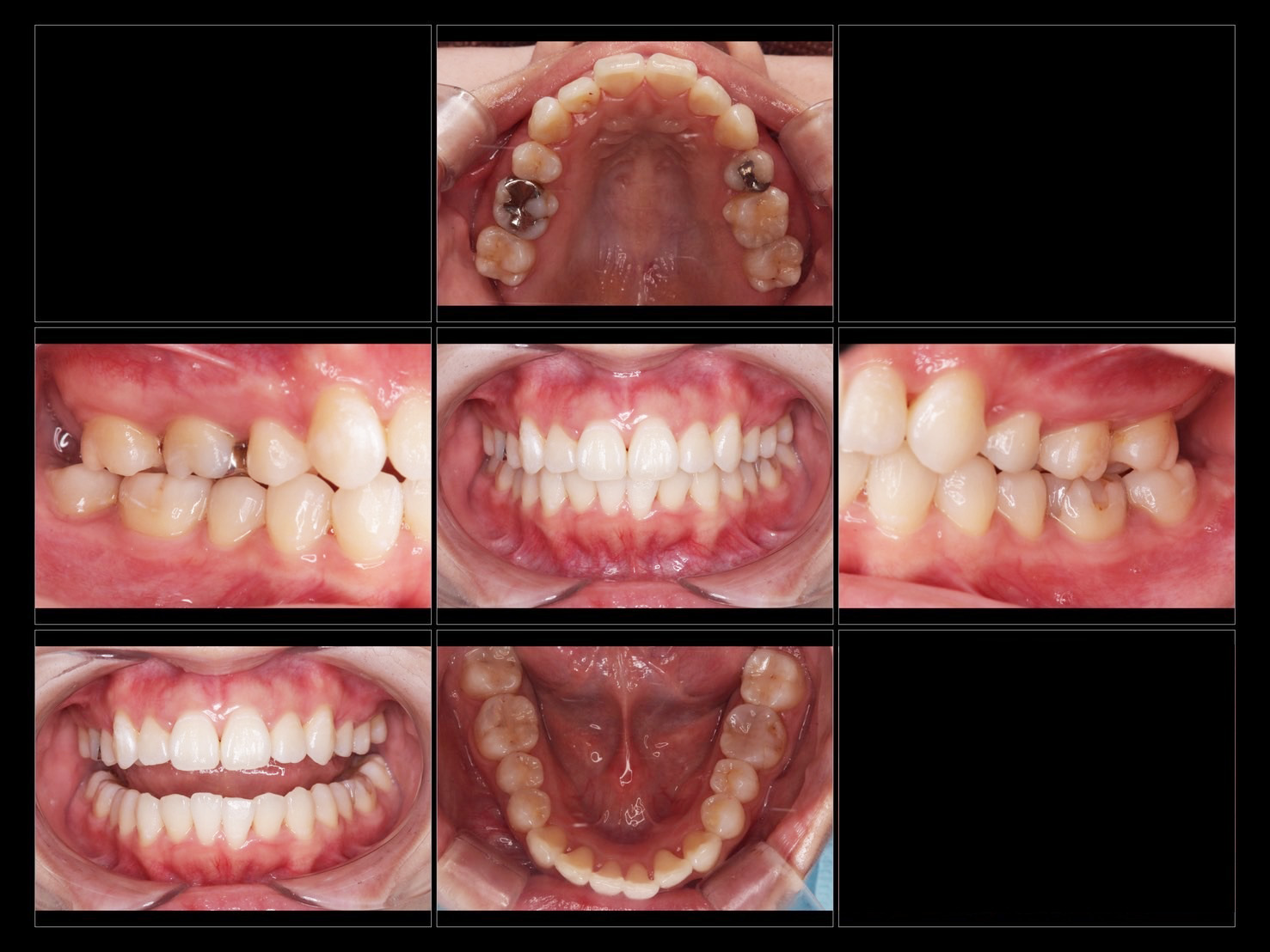 透明で目立たない