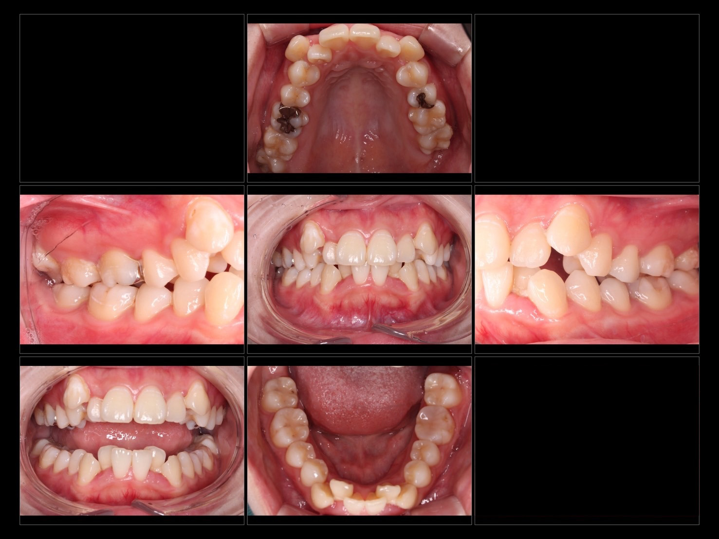 世界シェアNo.1安心と信頼のマウスピース