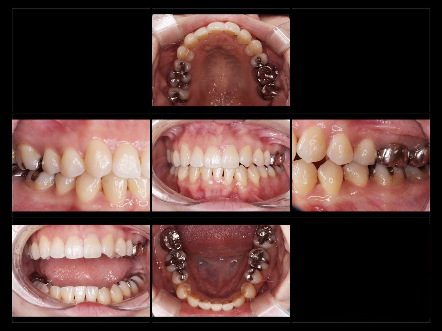 透明で目立たない