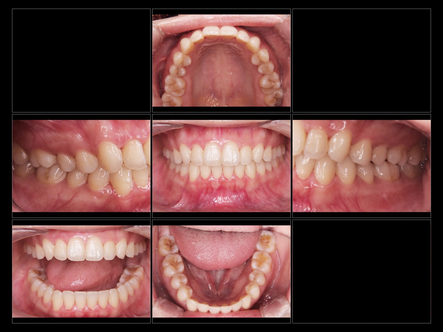 透明で目立たない